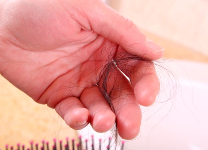 M&atilde;o com fios de cabelo ca&iacute;dos